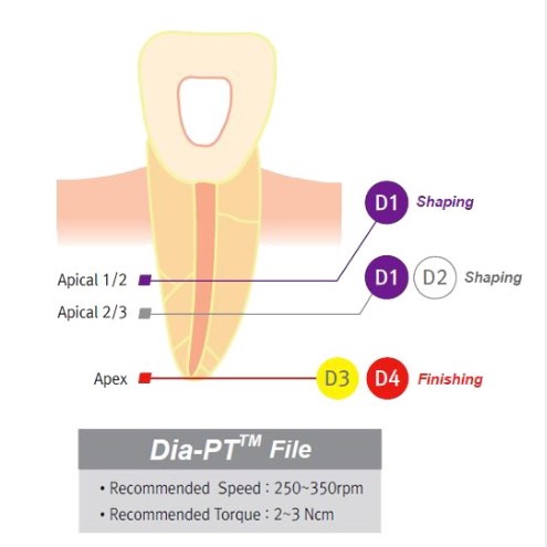 Lima Endo Reciprocante. Solo File Niti - 25mm - IMD (copia)