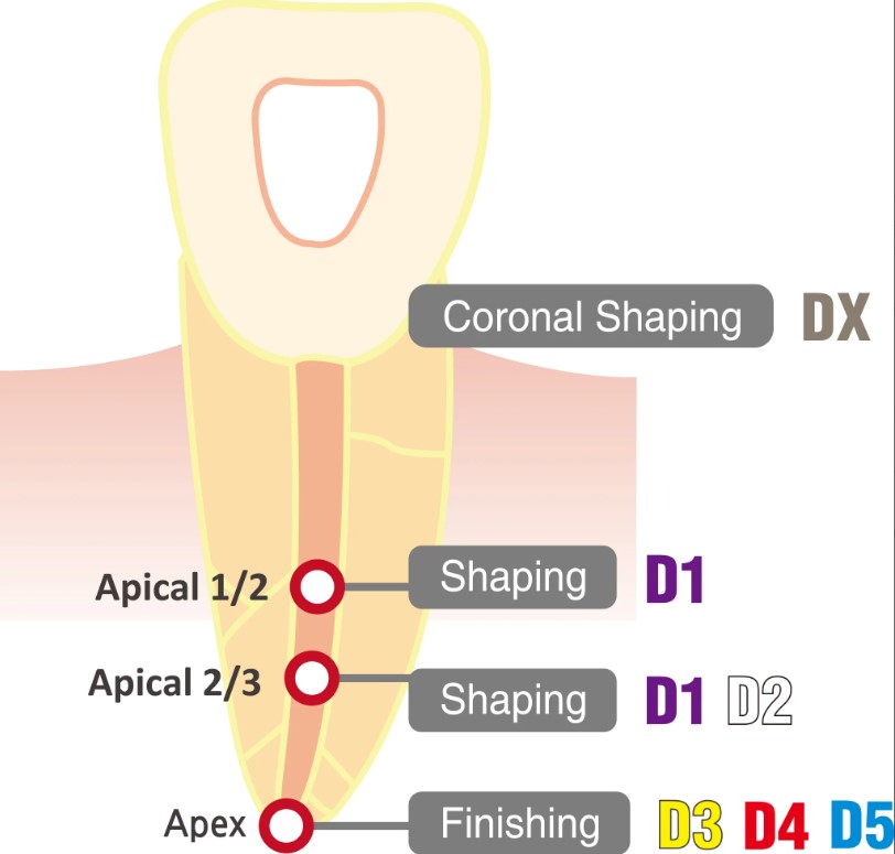 Lima Endo Reciprocante. Solo File Niti - 25mm - IMD (copia)