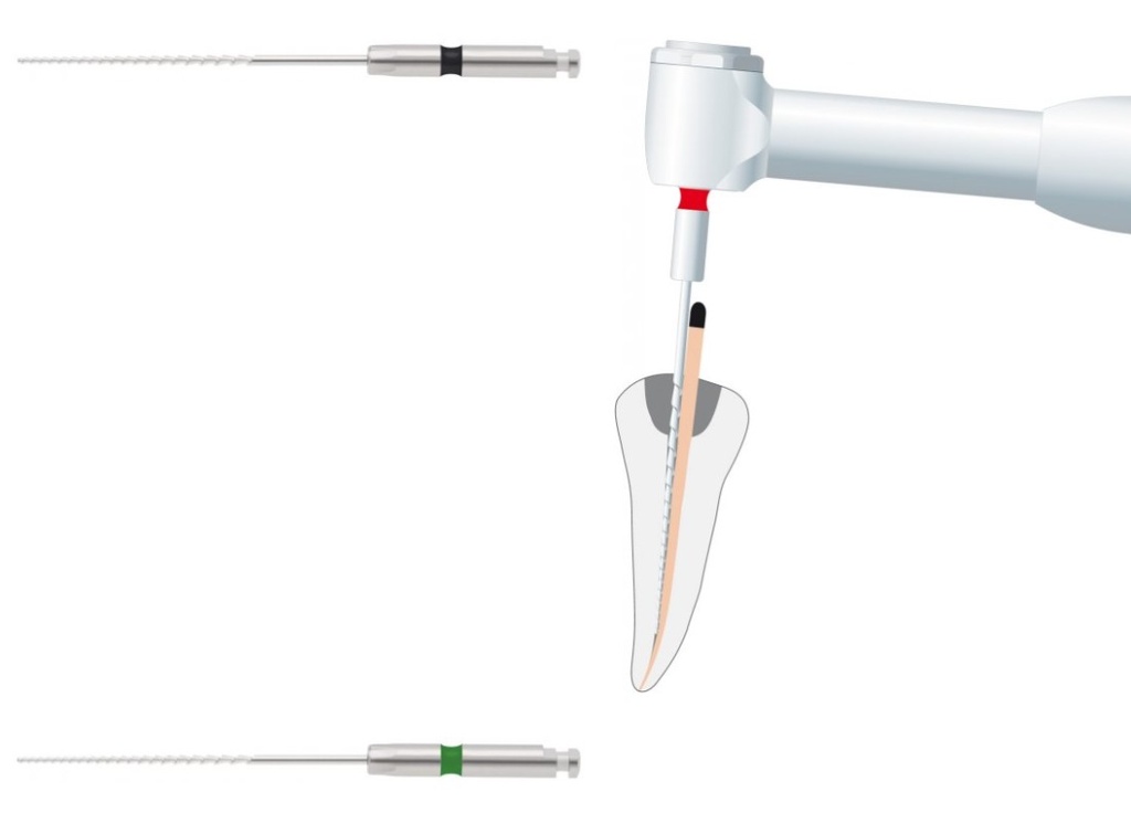 Condensador de guta mecanizada - Gutta condensor - 25mm - Medin