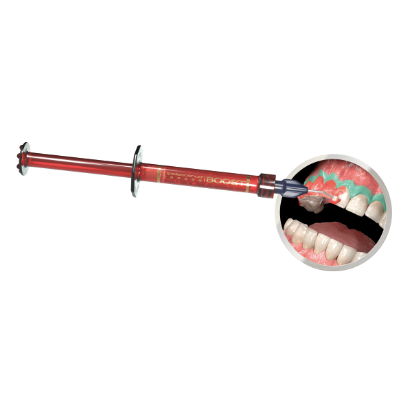 Blanqueador Opalescence BOOST 40% per.hidr. 1 jeringa - Ultradent