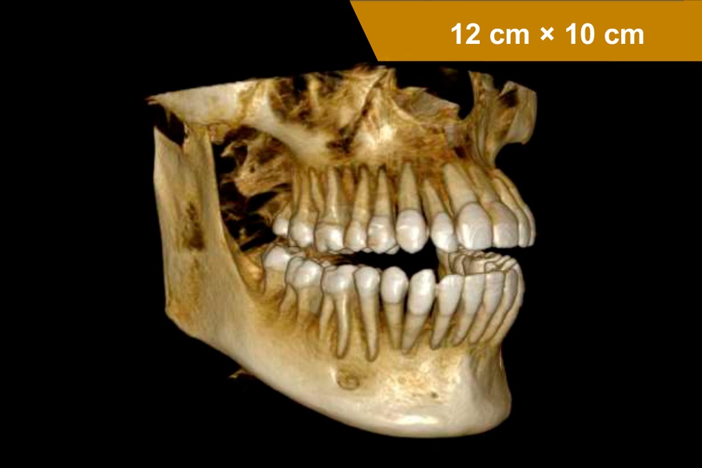 Equipo de rayos CS 8200 3D - Carestream