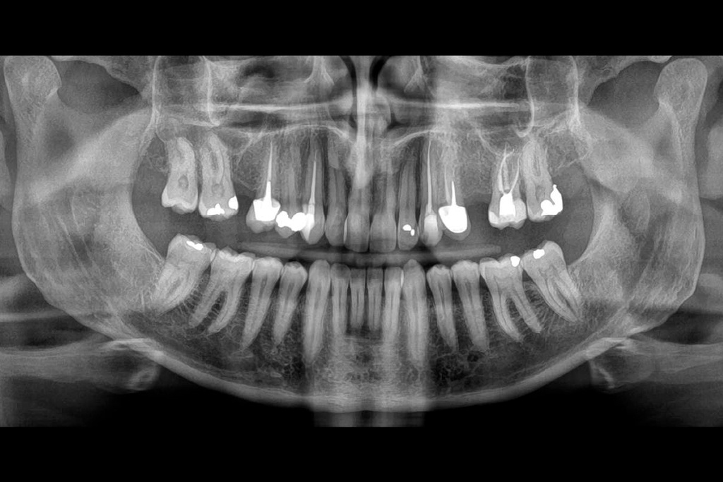 Equipo de rayos CS 8200 3D - Carestream