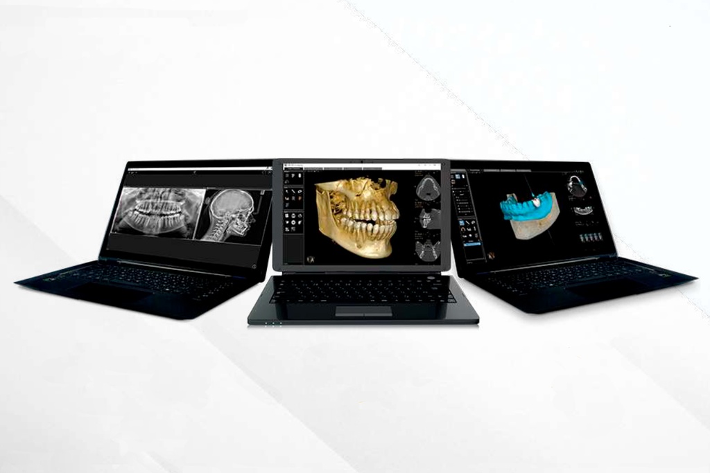 Equipo de rayos CS 8200 3D - Carestream