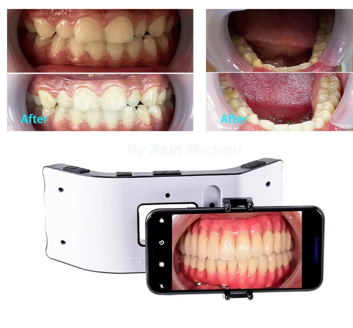 Cámara Intraoral BND X6 - Foshan Voten