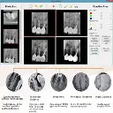 Radiovisógrafo  Sensor RX Digital HDR 600 - Handy