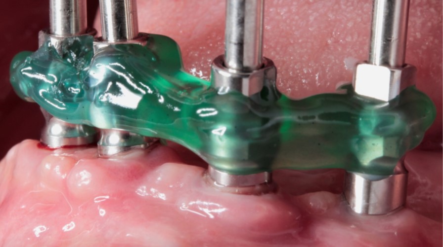 Resina Acrílica  en gel - foto p/ modelado  - 
Resinlay   Pattern Photo - TDV