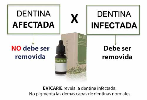 Cariostático CARIESTOP - 5 ml - Biodinamica