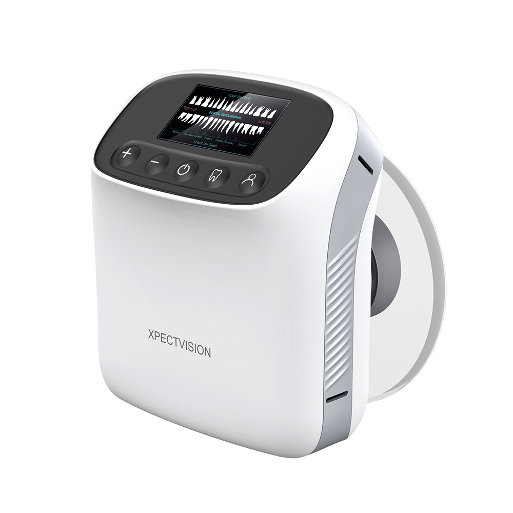 Equipo de rayos RX  Portátil  Vbean2000 - Xpect Vision