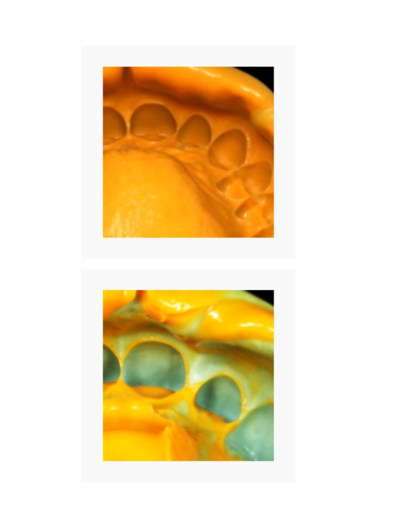 Intro Kit L Zetaplus,  Silicona Pesada x 900ml+  liviana x 140ml + Activador -  Zhermack