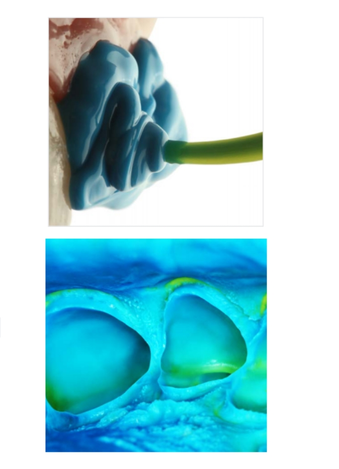 Silicona Light Body por  adición Elite HD+  Normal Set 2 x 50ml - Zhermack