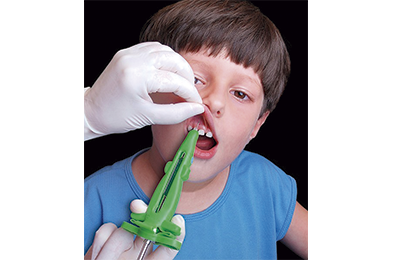 Blanqueador Ambulatorio Peróxido Carbamida - Clariant Home - Angelus