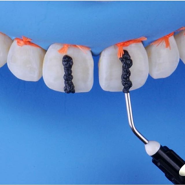 Blanqueador  Whiteness RM a base de ácido clorhidrico 6% y carburo de silicio - FGM