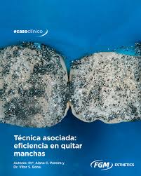 Blanqueador  Whiteness RM a base de ácido clorhidrico 6% y carburo de silicio - FGM