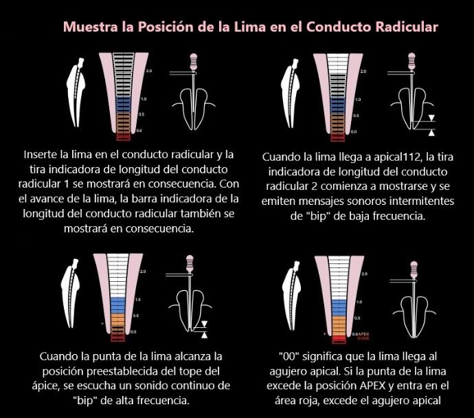 Localizador Apical Woodpex V - Woodpecker 