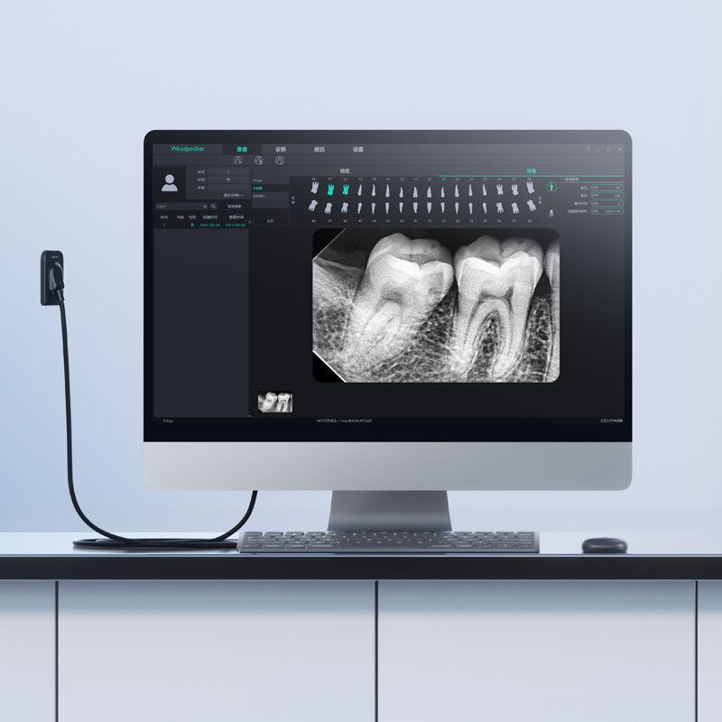 Radiovisógrafo Sensor RX Digital - i SENSOR  H1,5 - Woodpecker