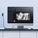 Radiovisógrafo Sensor RX Digital - i SENSOR  H1,5 - Woodpecker