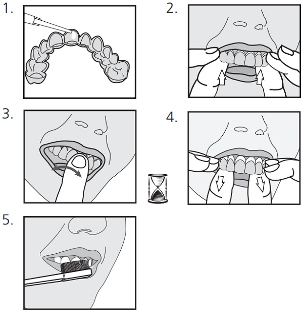 Blanqueador Pola Night - Ambulatorio - 9 un - Carbamida - SDI