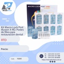 Kit Macro-Lock Post Illusion X-RO. Postes de fibra para restauración dental - RTD